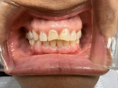 Patient 10, September 26, 2025, photo 9