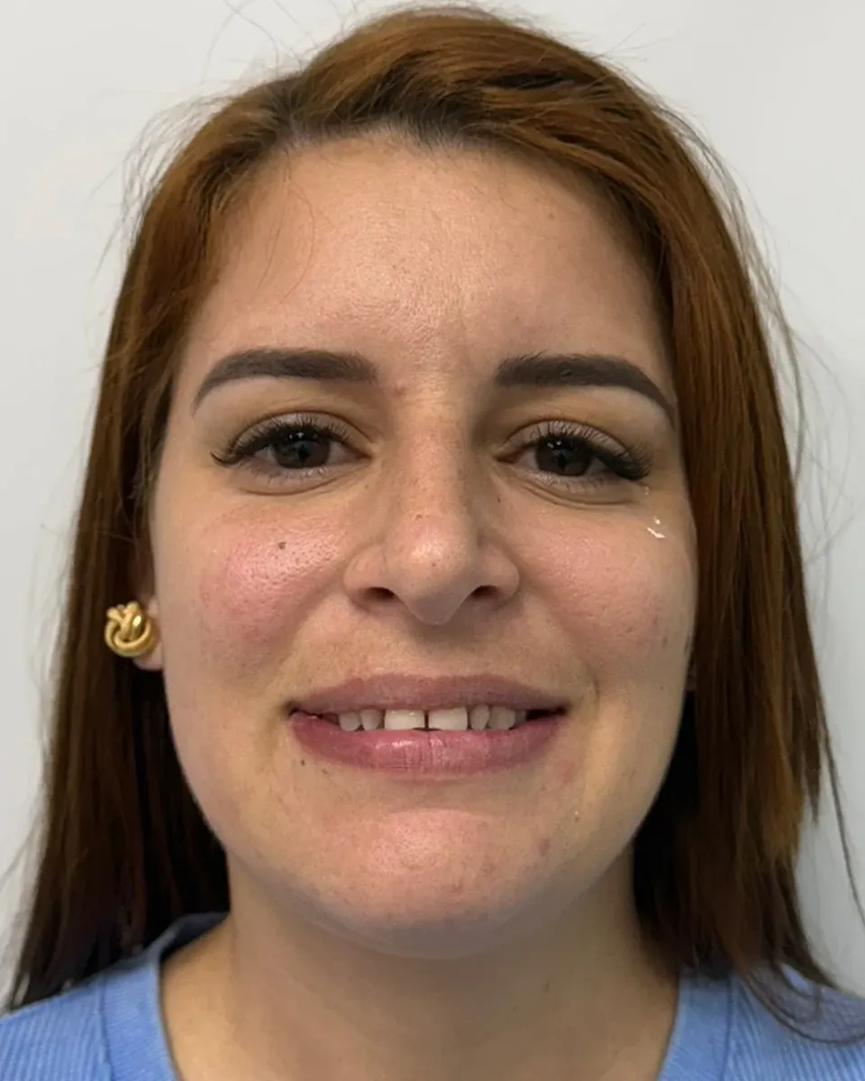 Patient 12, before