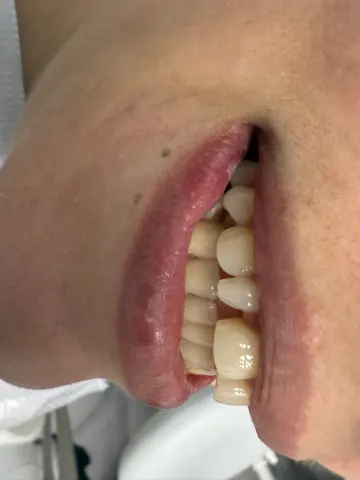 Patient 12, January 9, 2025, photo 4