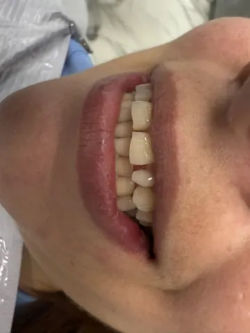 Patient 12, January 9, 2025, photo 5