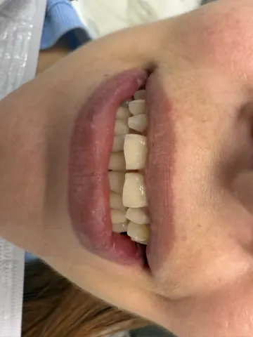 Patient 12, January 9, 2025, photo 6