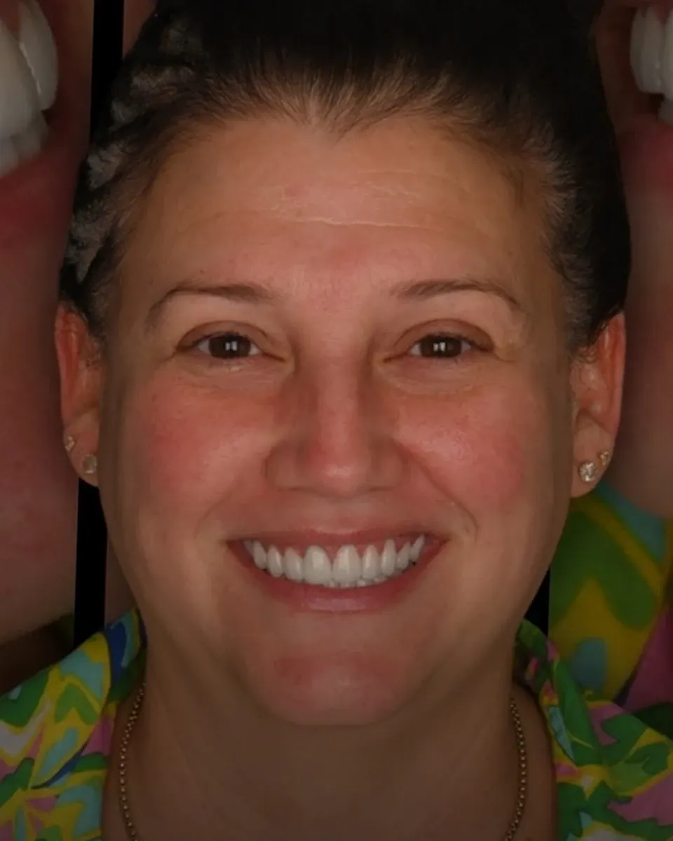 Patient 15, after