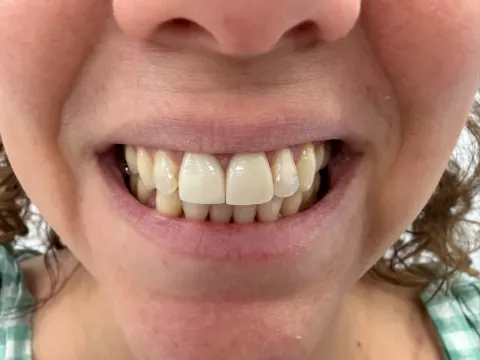 Patient 15, April 21, 2026, photo 4