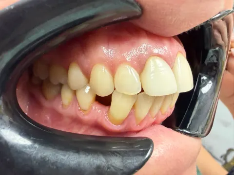 Patient 15, April 21, 2026, photo 9
