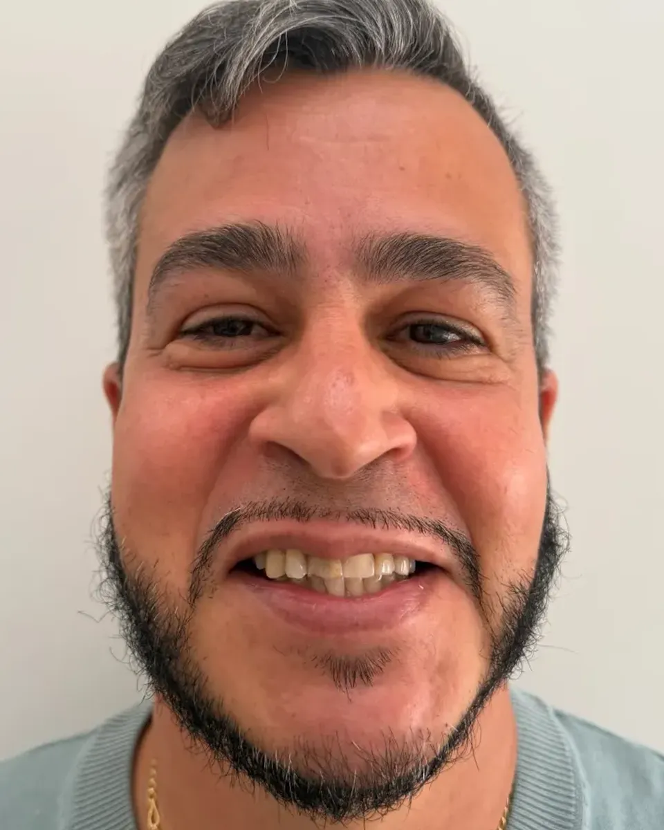 Patient 20, before