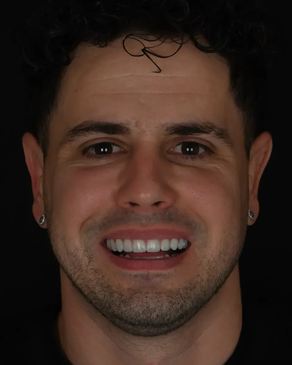 Patient 28, after