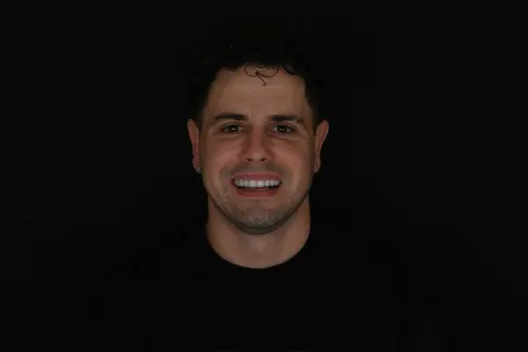 Patient 28, May 14, 2025, photo 11