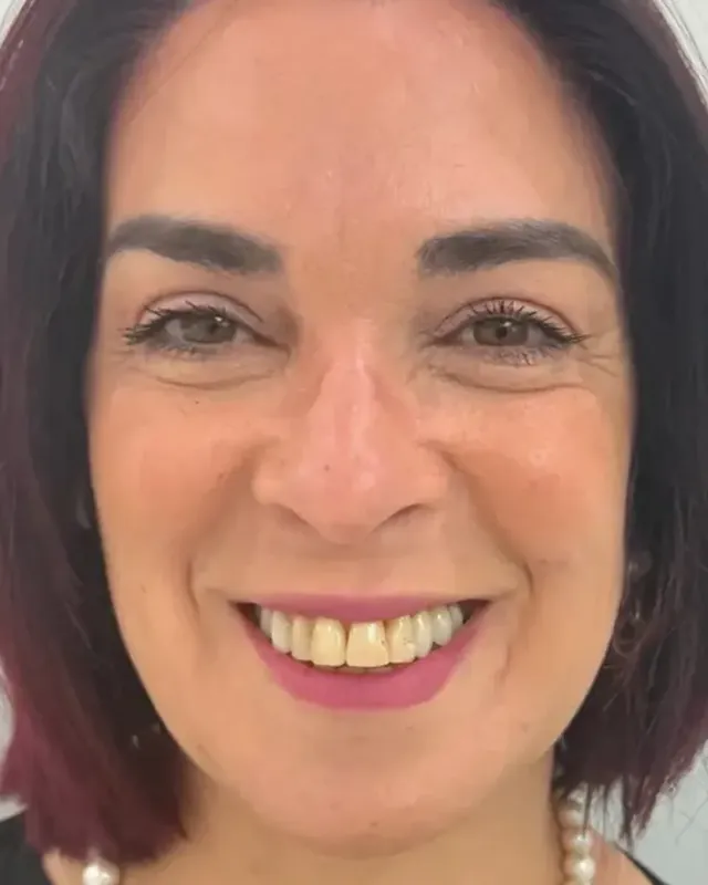 Patient 29, before