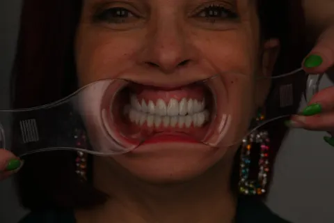 Patient 29, May 28, 2026, photo 22
