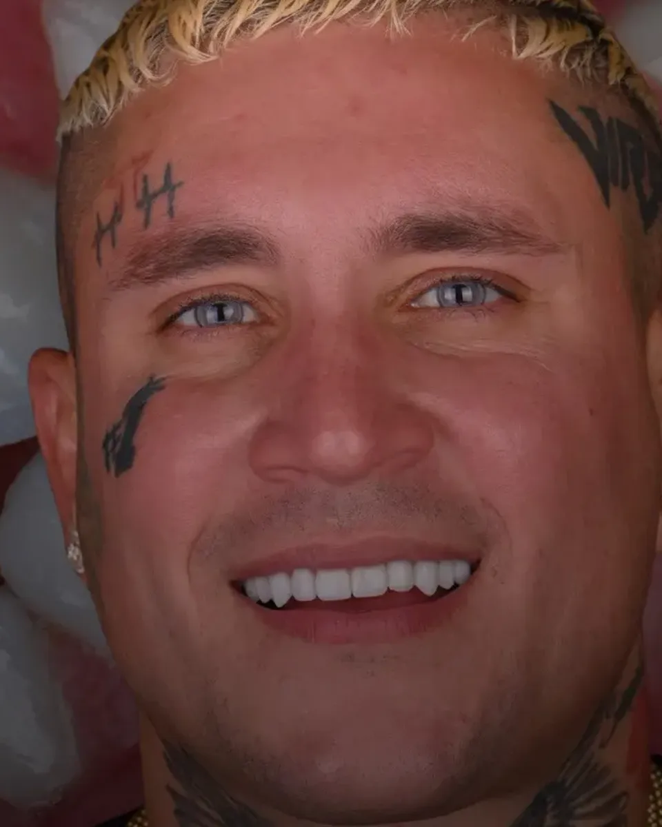 Patient 31, after