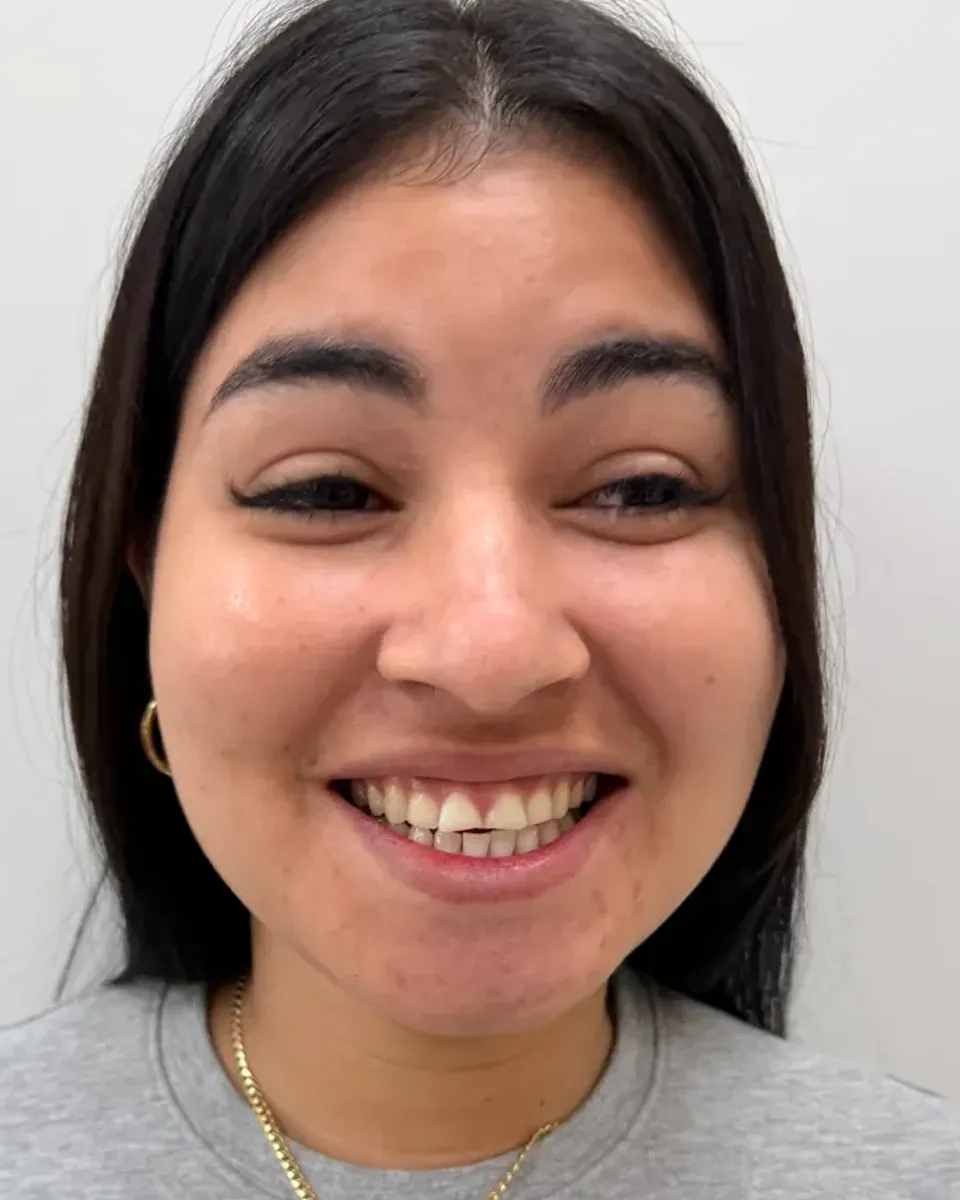 Patient 38, before