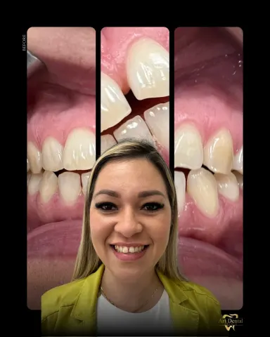 Patient 4, January 9, 2026, photo 22