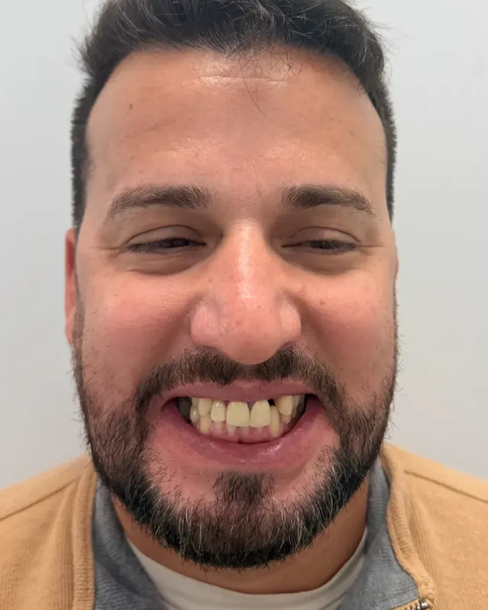 Patient 43, before