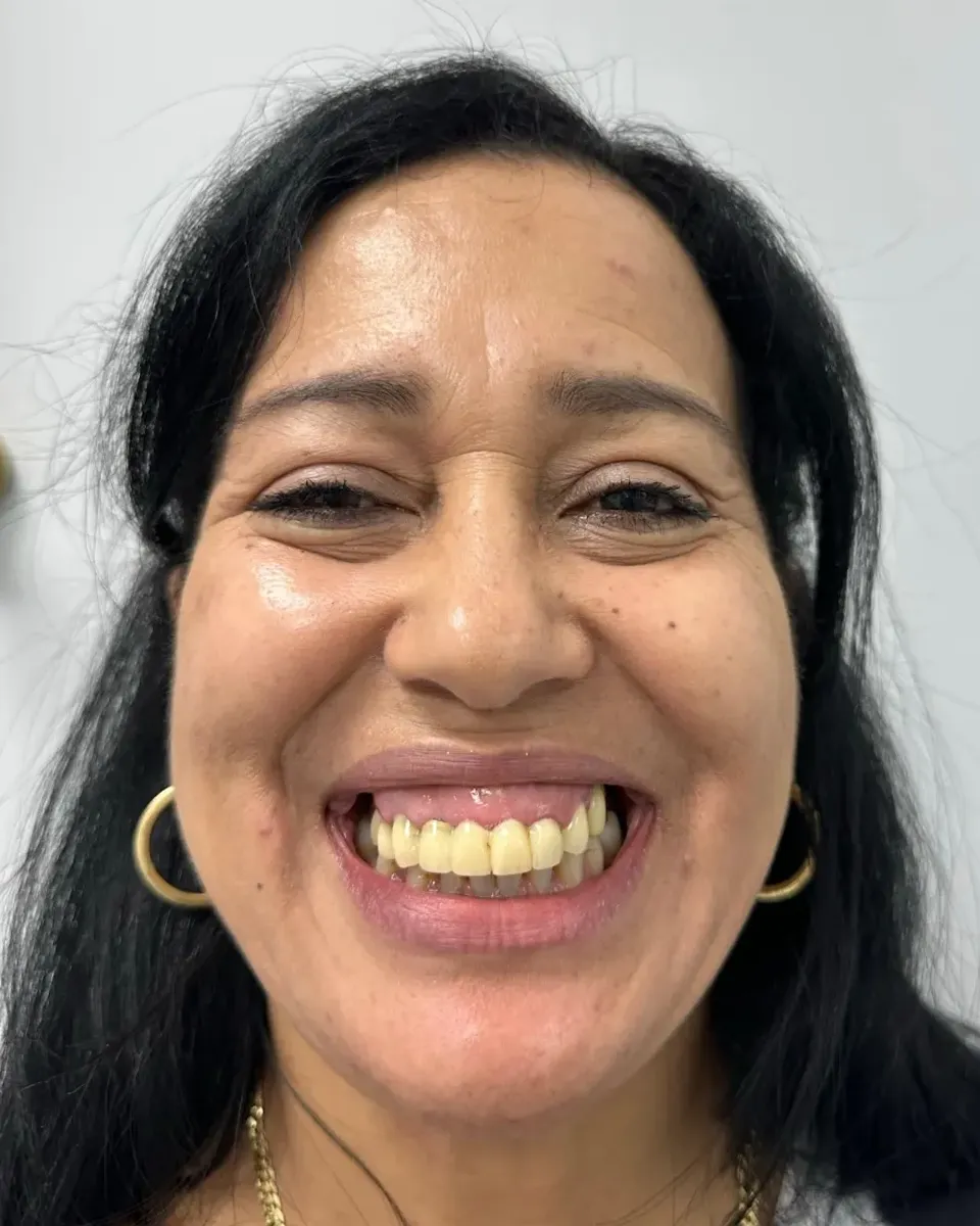 Patient 44, before