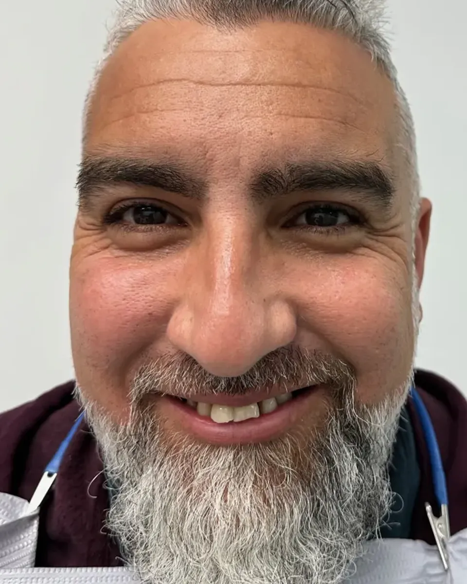Patient 45, before