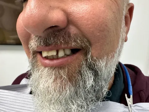 Patient 45, January 19, 2023, photo 5