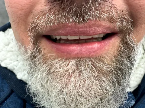 Patient 45, January 26, 2023, photo 7