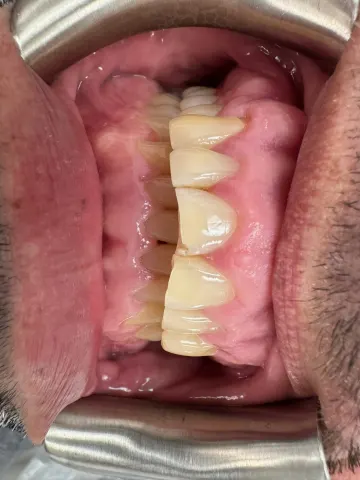 Patient 5, February 5, 2024, photo 8