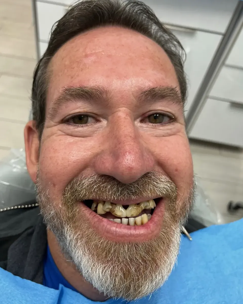 Patient 52, before