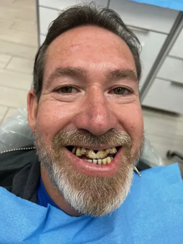 Patient 52, February 2, 2022, photo 1