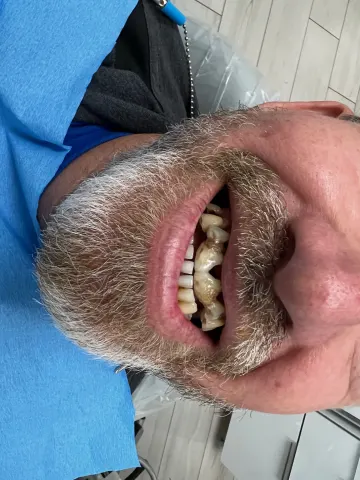 Patient 52, February 2, 2022, photo 2