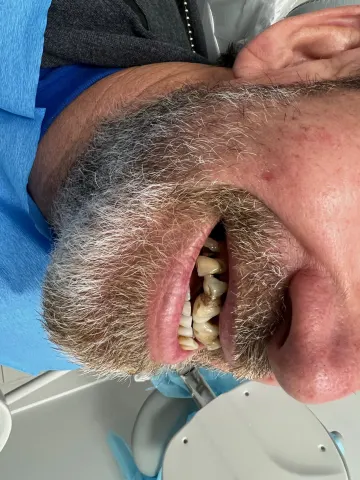 Patient 52, February 2, 2022, photo 3