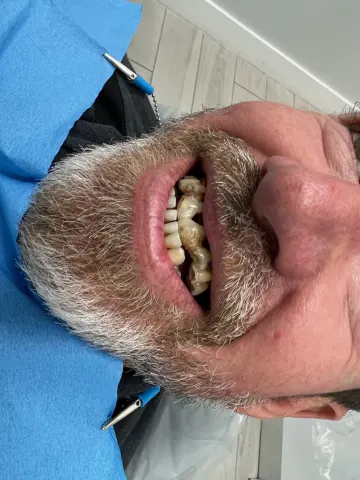 Patient 52, February 2, 2022, photo 4