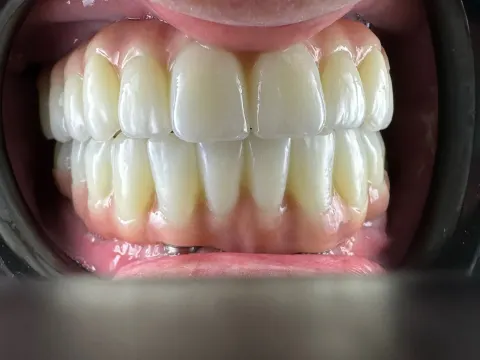 Patient 52, January 18, 2023, photo 6