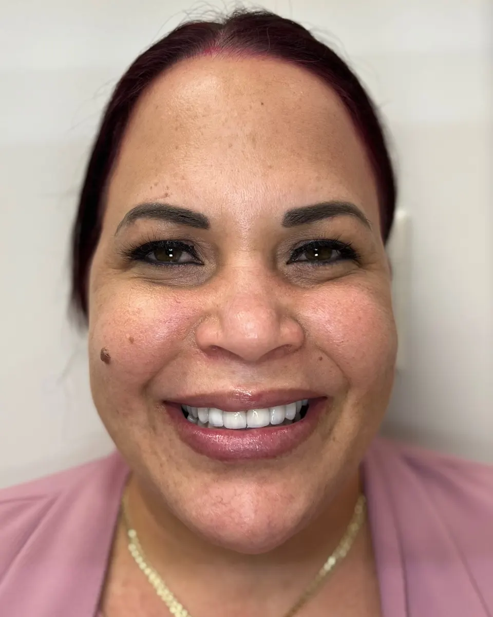 Patient 53, after