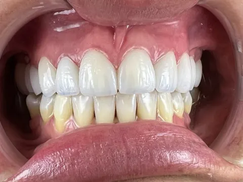 Patient 53, April 23, 2022, photo 14