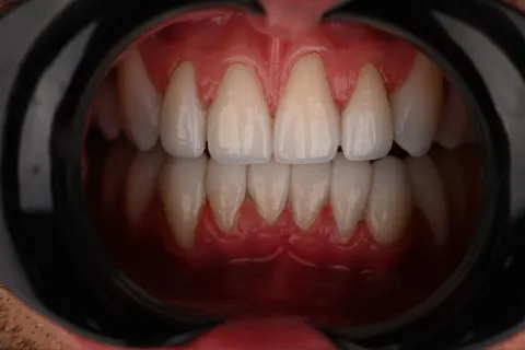 Patient 54, December 10, 2025, photo 19