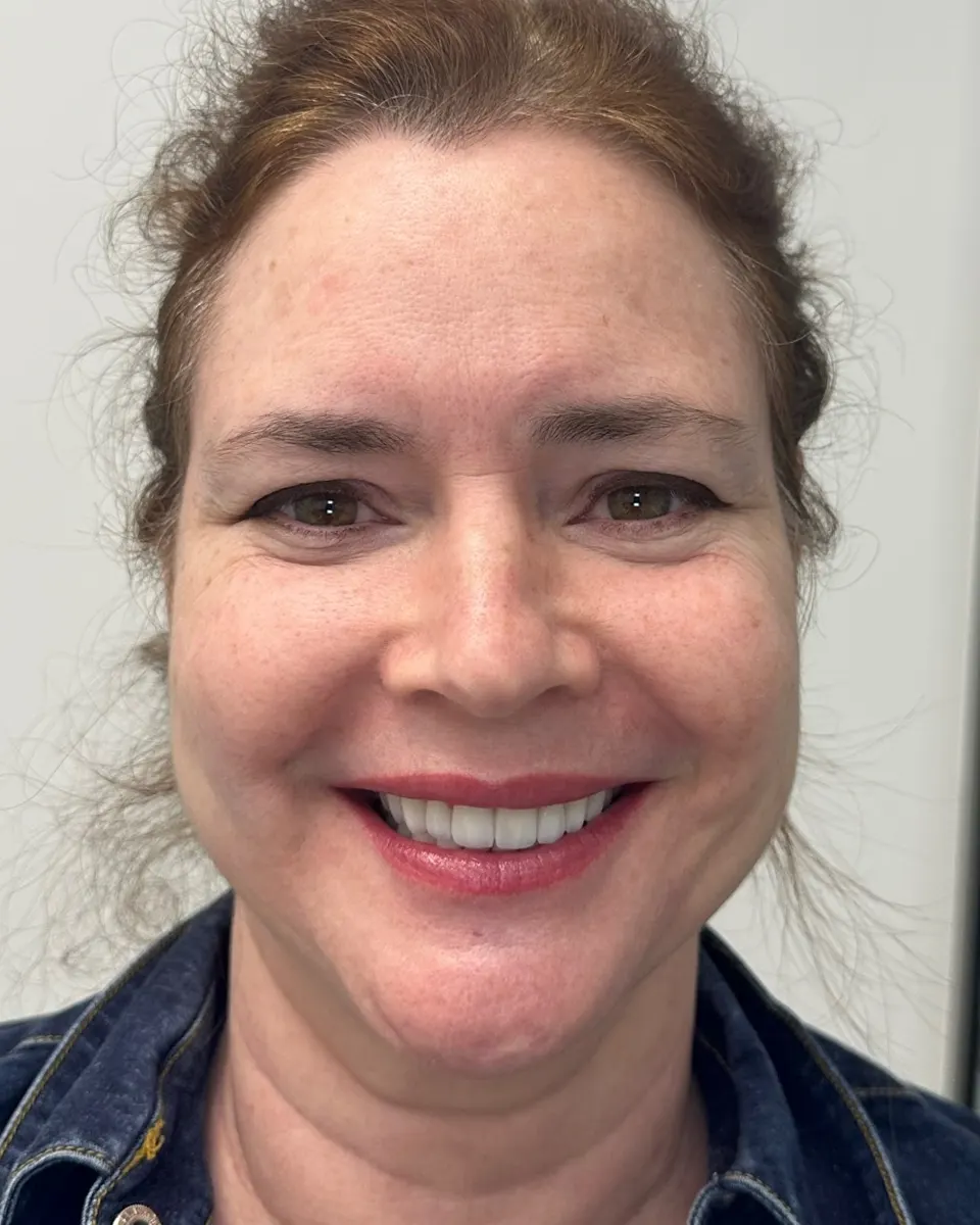 Patient 56, after