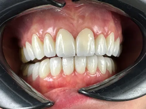 Patient 56, July 28, 2023, photo 6