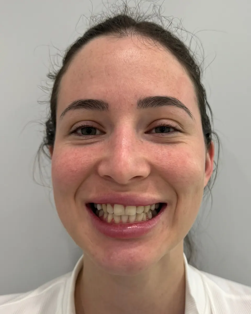 Patient 57, before
