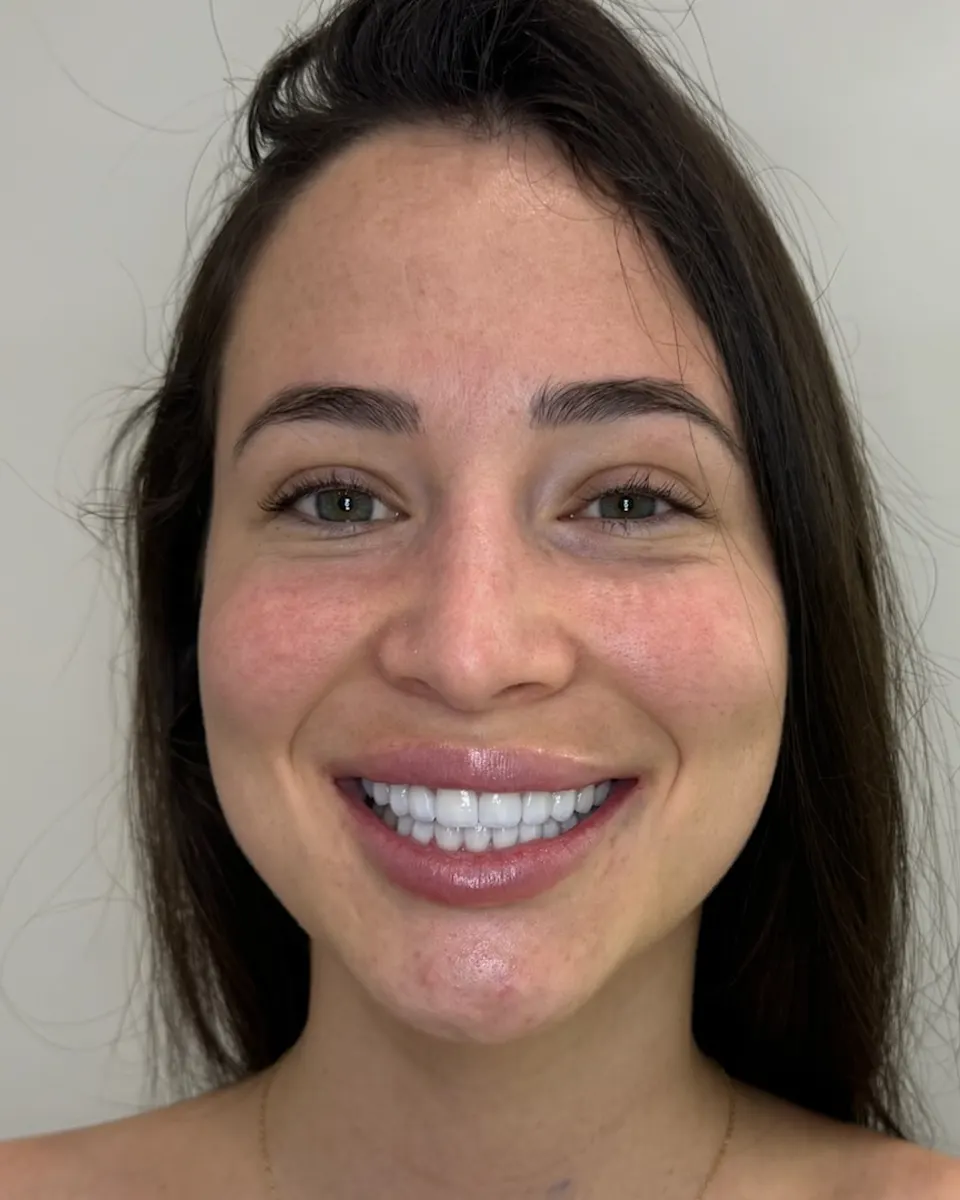 Patient 57, after
