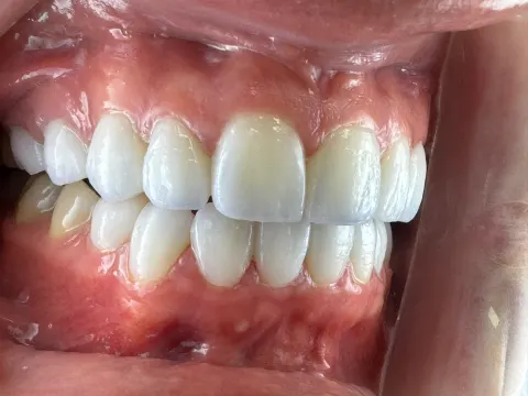 Patient 57, October 4, 2024, photo 13