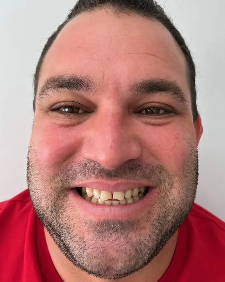 Patient 58, before