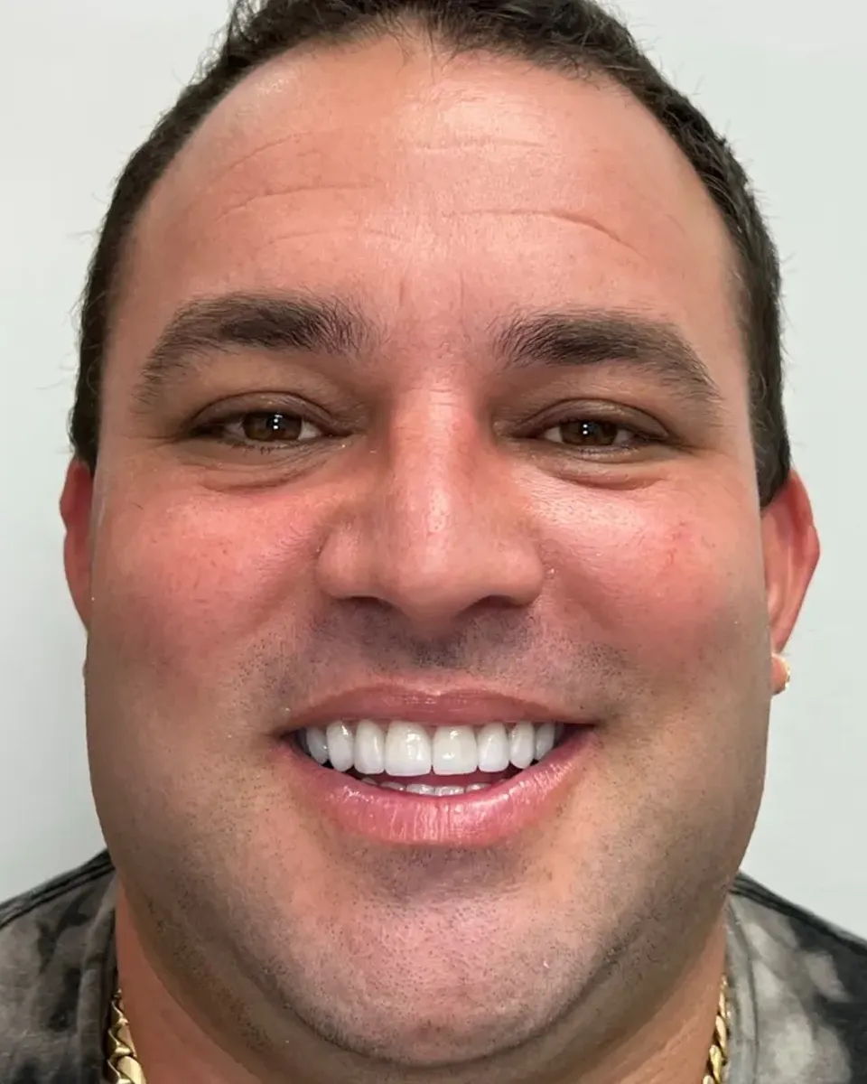 Patient 58, after