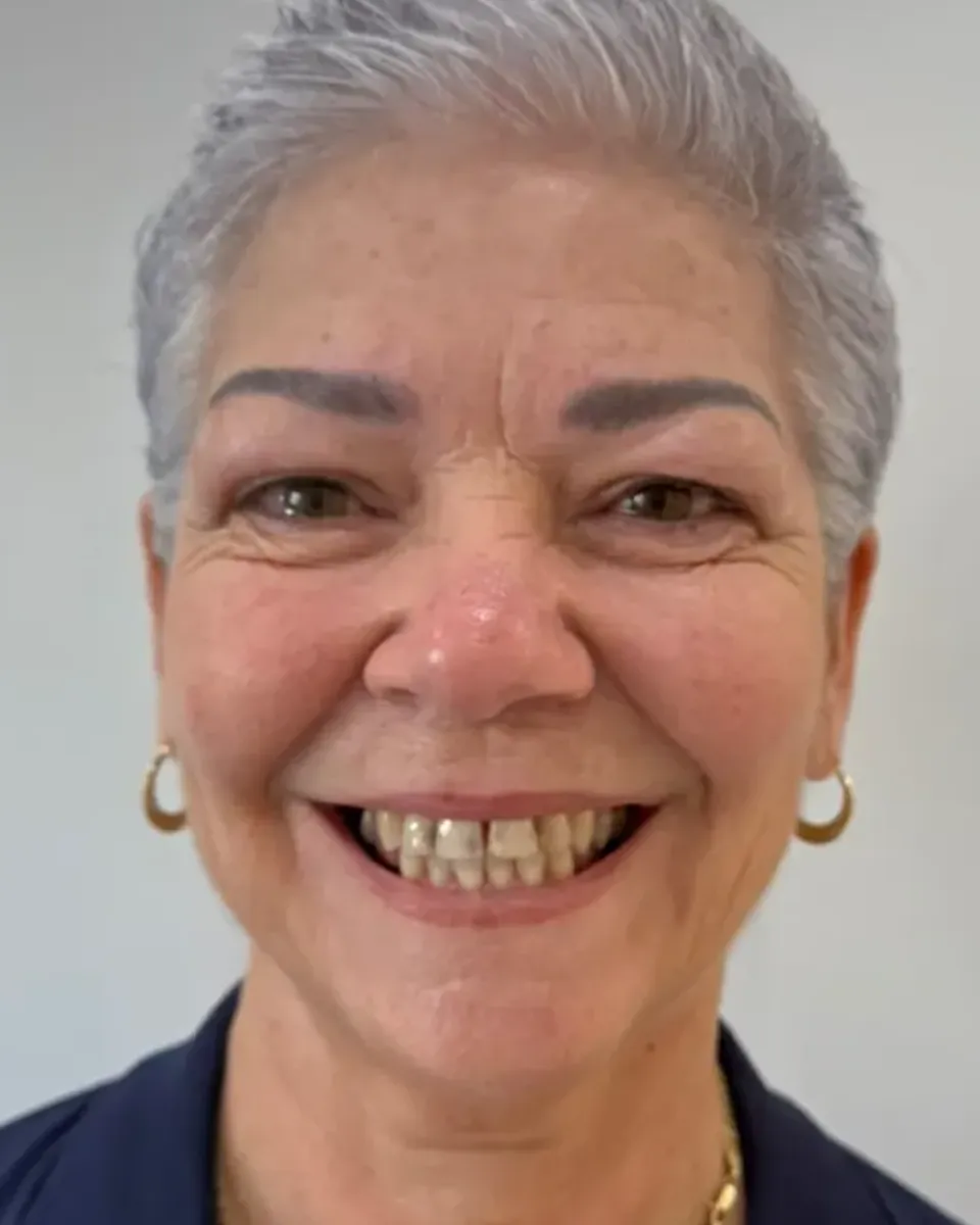Patient 61, before