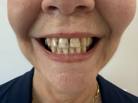 Paciente 61, 14 de mayo de 2025, foto 3