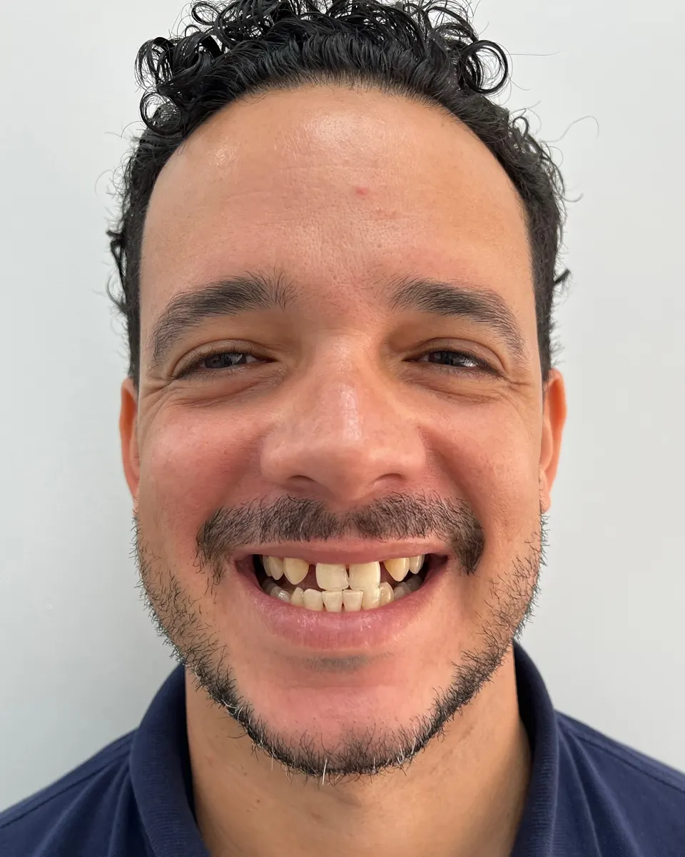 Patient 64, before