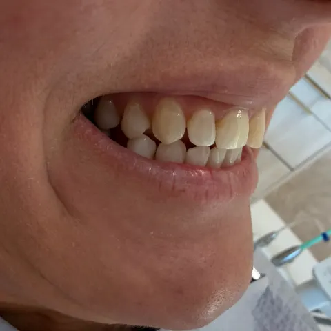 Patient 66, February 4, 2026, photo 7
