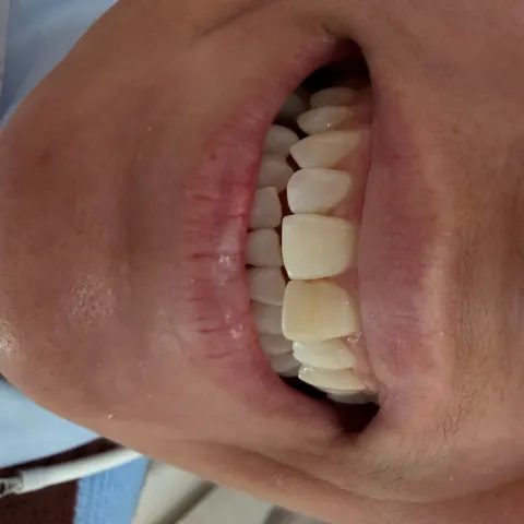 Patient 66, February 4, 2026, photo 8