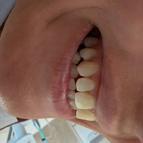 Patient 66, February 4, 2026, photo 9