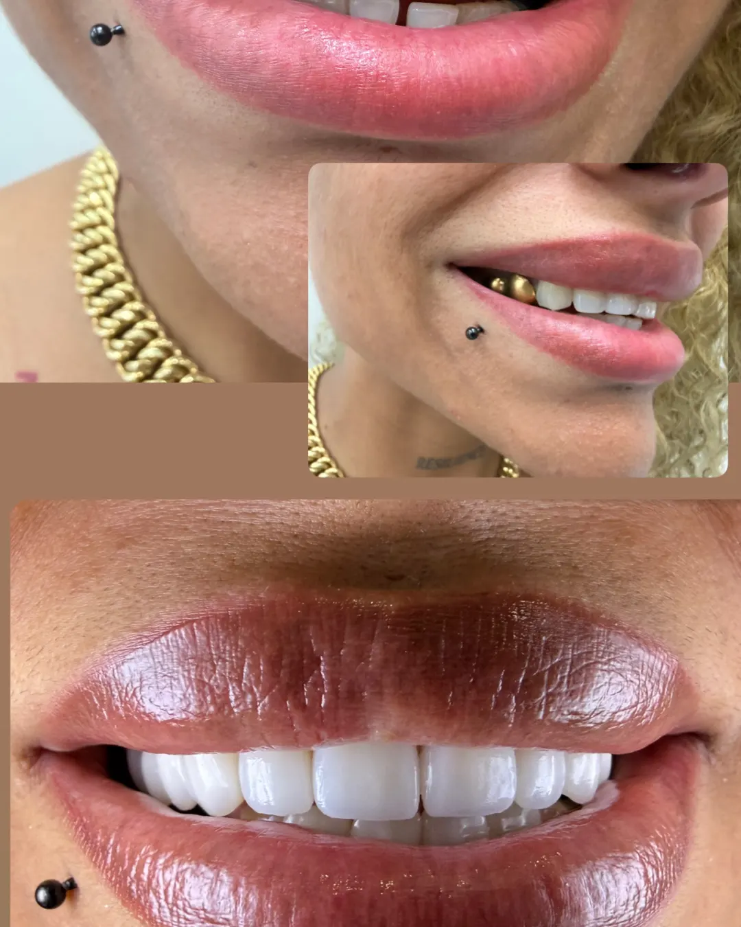 Patient 67: before / after