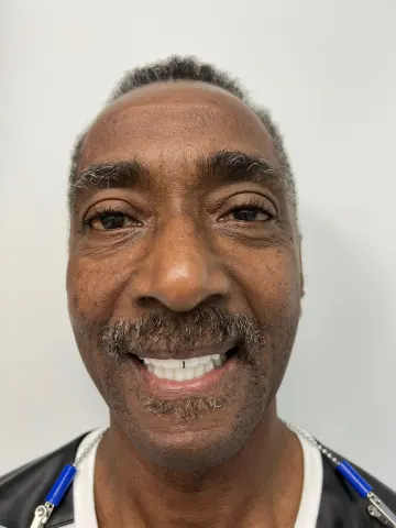 Patient 68, July 14, 2022, photo 1