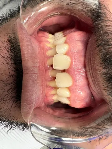 Patient 69, February 15, 2022, photo 8