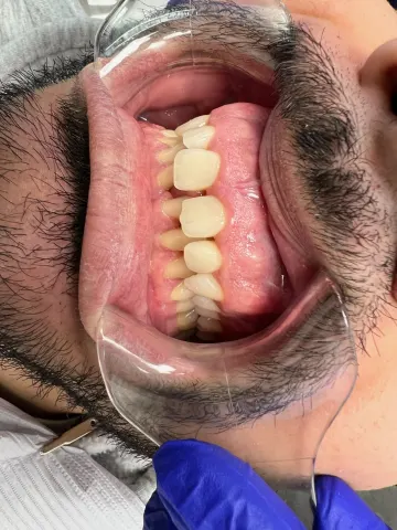 Patient 69, February 15, 2022, photo 9