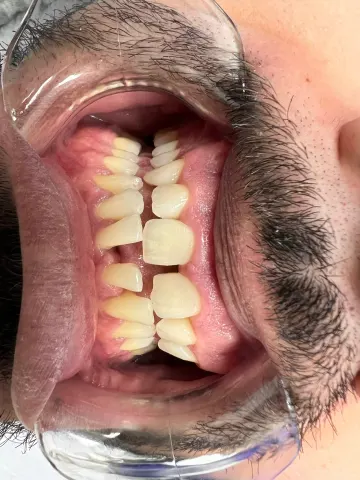 Patient 69, February 15, 2022, photo 11
