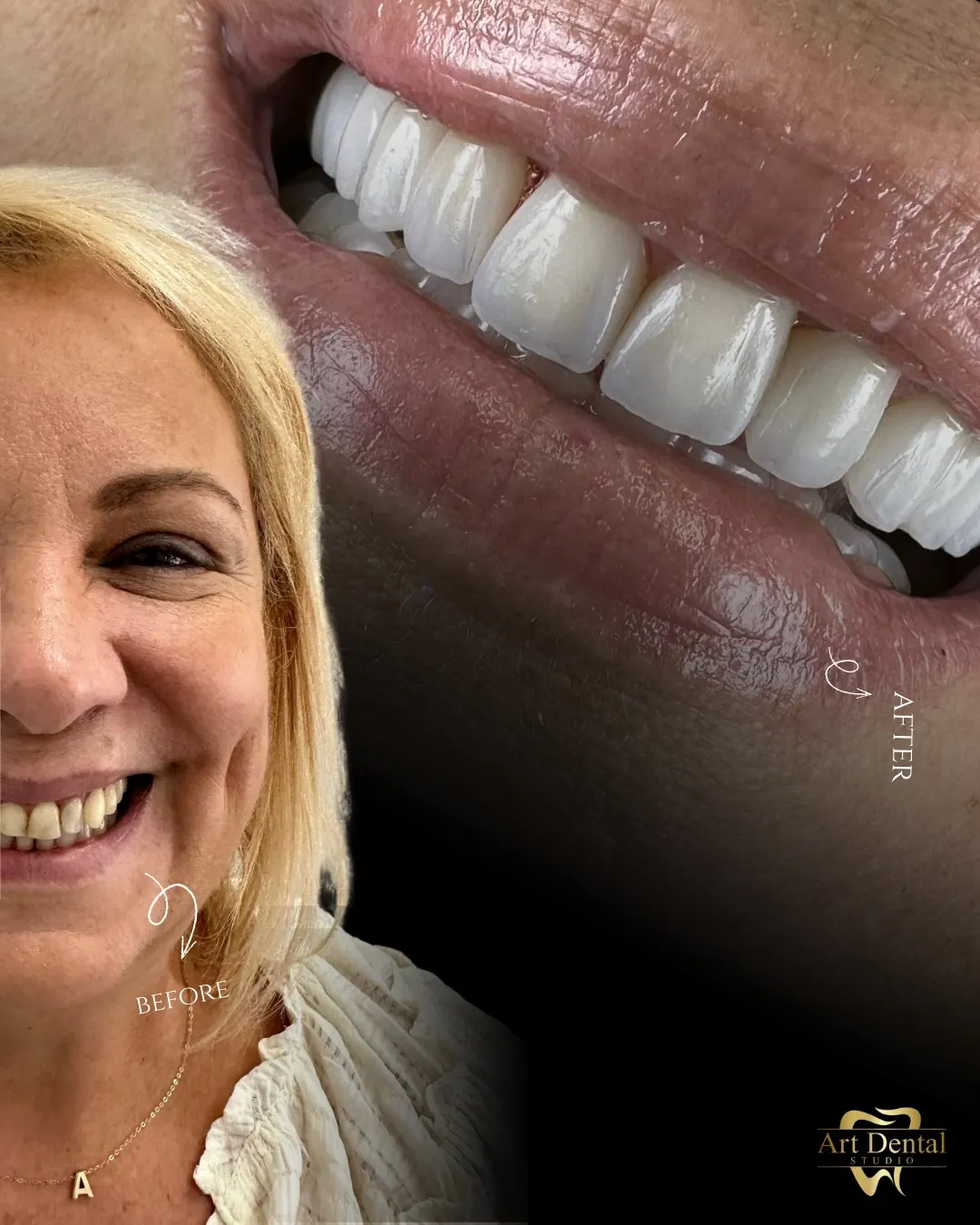 Patient 70: before / after